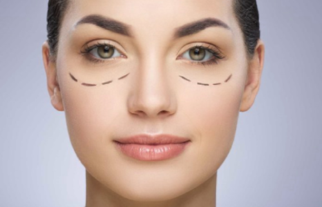 Correção de Pálpebras Caídas